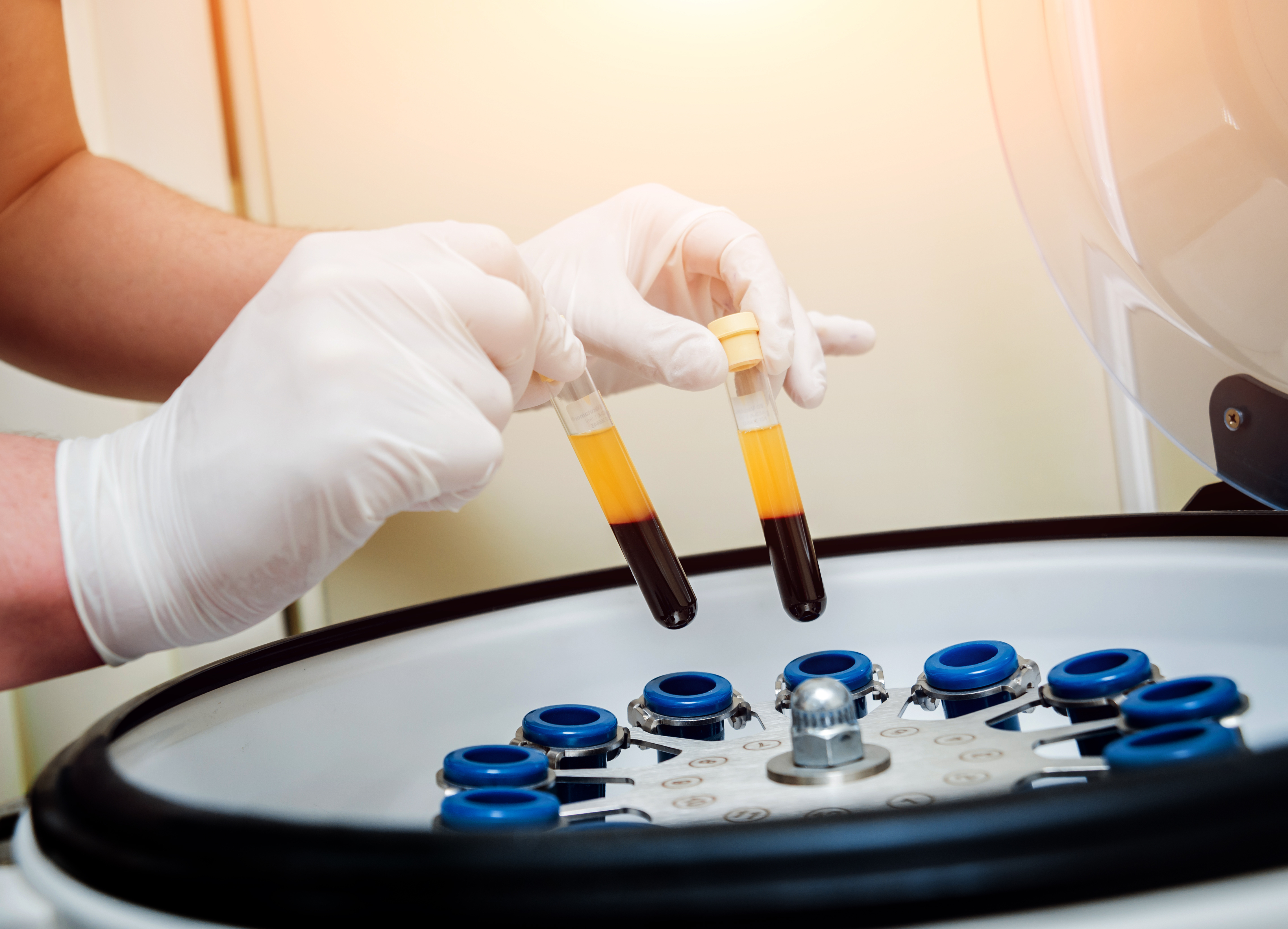 PRP centrifuge PRP centrifuge